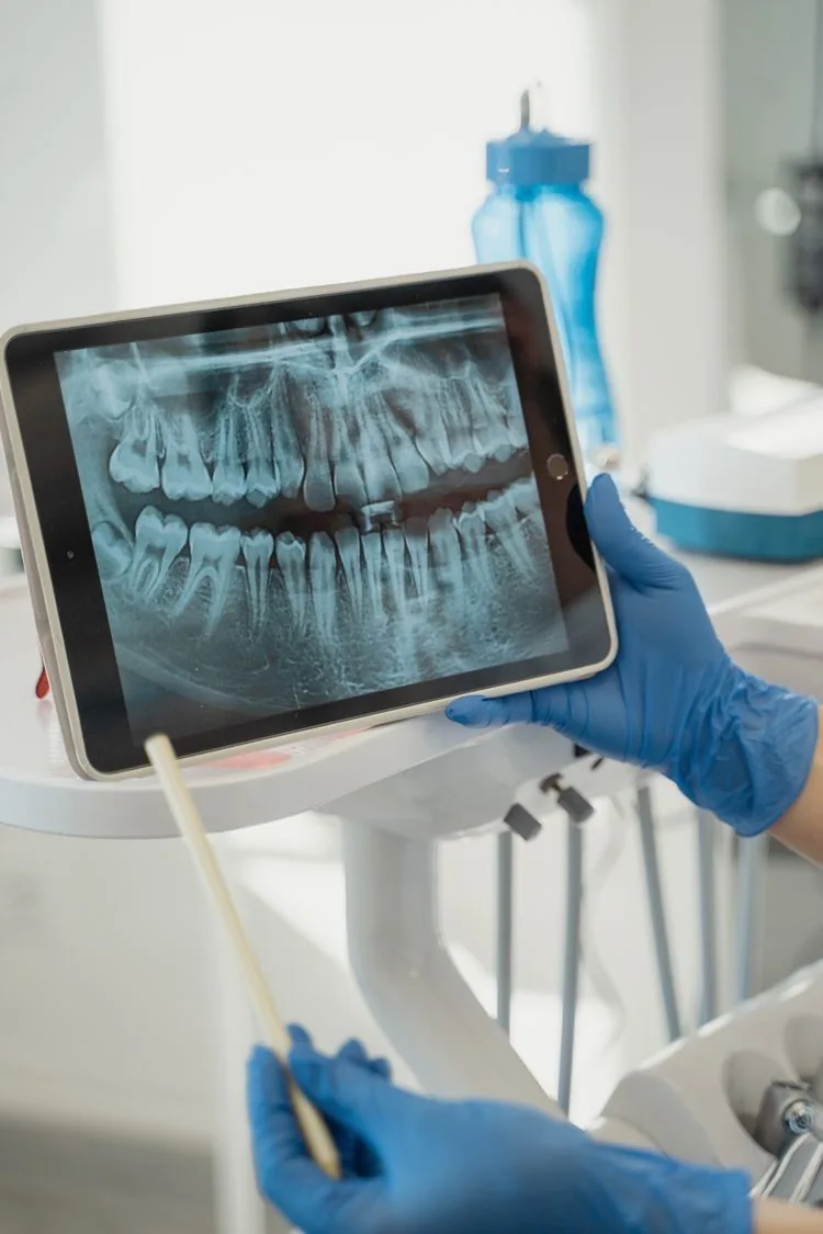 Radiografia panorâmica numa tela, apontada pela dentista de luvas azuis